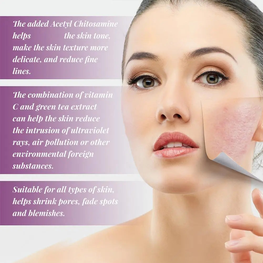 Niacinamide Serum Skin Brightening & Dark Spot Lightening Serum,  20% High Potency Formula, Lifts Nasal Lines for Smooth Skin