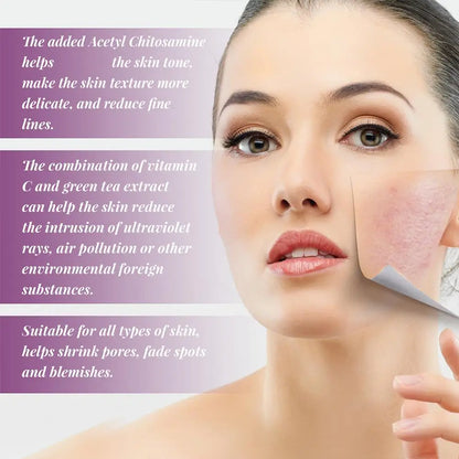 Niacinamide Serum Skin Brightening & Dark Spot Lightening Serum,  20% High Potency Formula, Lifts Nasal Lines for Smooth Skin