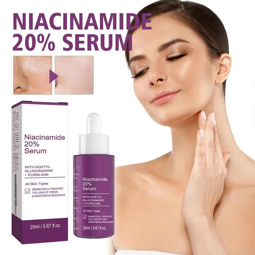 Niacinamide Serum Skin Brightening & Dark Spot Lightening Serum,  20% High Potency Formula, Lifts Nasal Lines for Smooth Skin