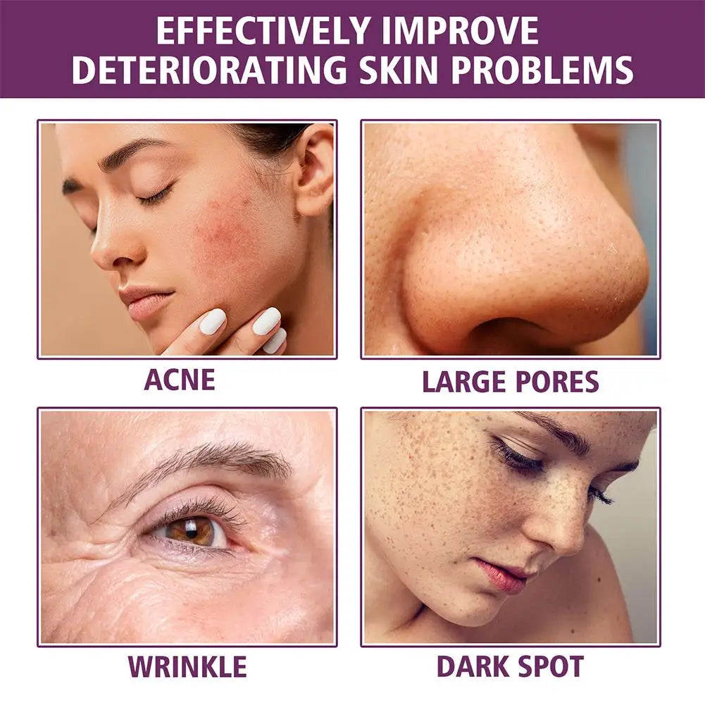 Niacinamide Serum Skin Brightening & Dark Spot Lightening Serum,  20% High Potency Formula, Lifts Nasal Lines for Smooth Skin