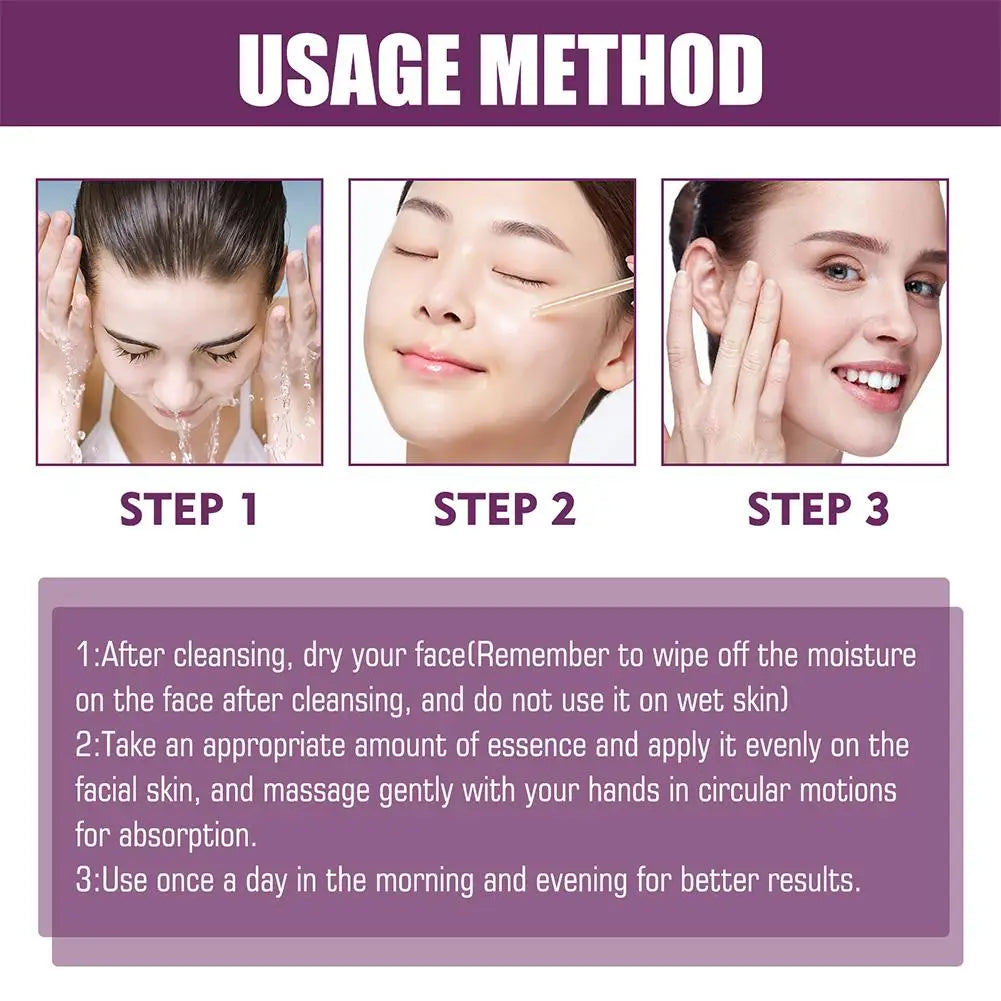 Niacinamide Serum Skin Brightening & Dark Spot Lightening Serum,  20% High Potency Formula, Lifts Nasal Lines for Smooth Skin