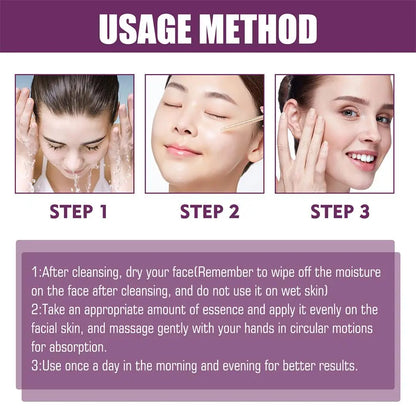 Niacinamide Serum Skin Brightening & Dark Spot Lightening Serum,  20% High Potency Formula, Lifts Nasal Lines for Smooth Skin
