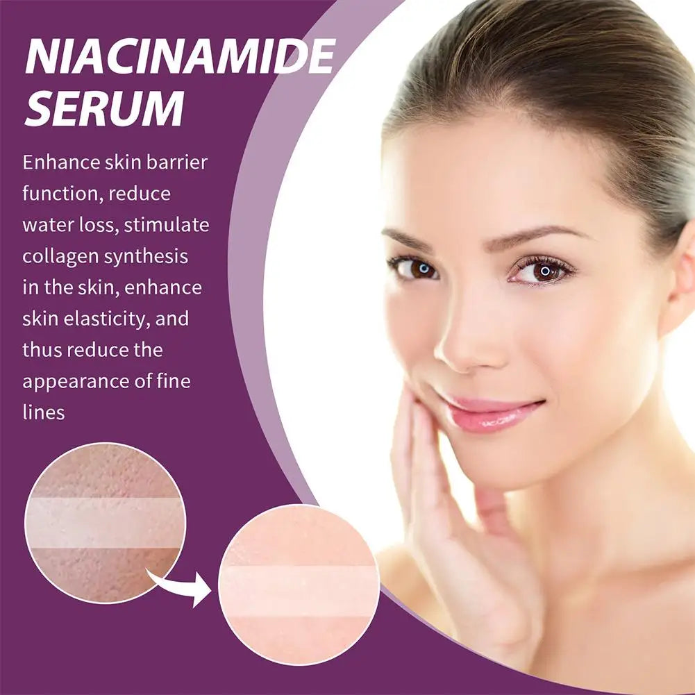 Niacinamide Serum Skin Brightening & Dark Spot Lightening Serum,  20% High Potency Formula, Lifts Nasal Lines for Smooth Skin