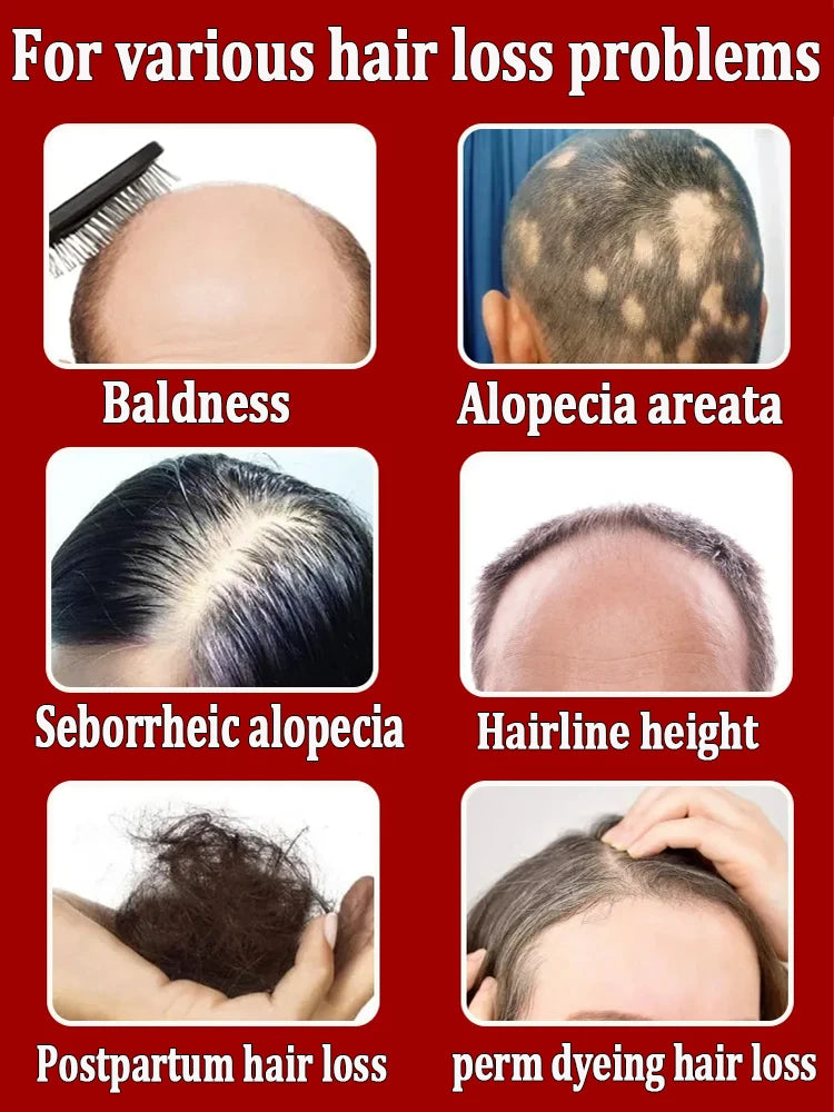Grow cool hair secretly and surprise everyone. Say goodbye to baldness and hair loss now
