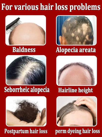 Grow cool hair secretly and surprise everyone. Say goodbye to baldness and hair loss now