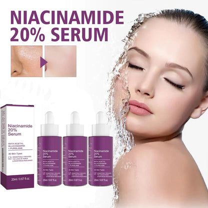 Niacinamide Serum Skin Brightening & Dark Spot Lightening Serum,  20% High Potency Formula, Lifts Nasal Lines for Smooth Skin
