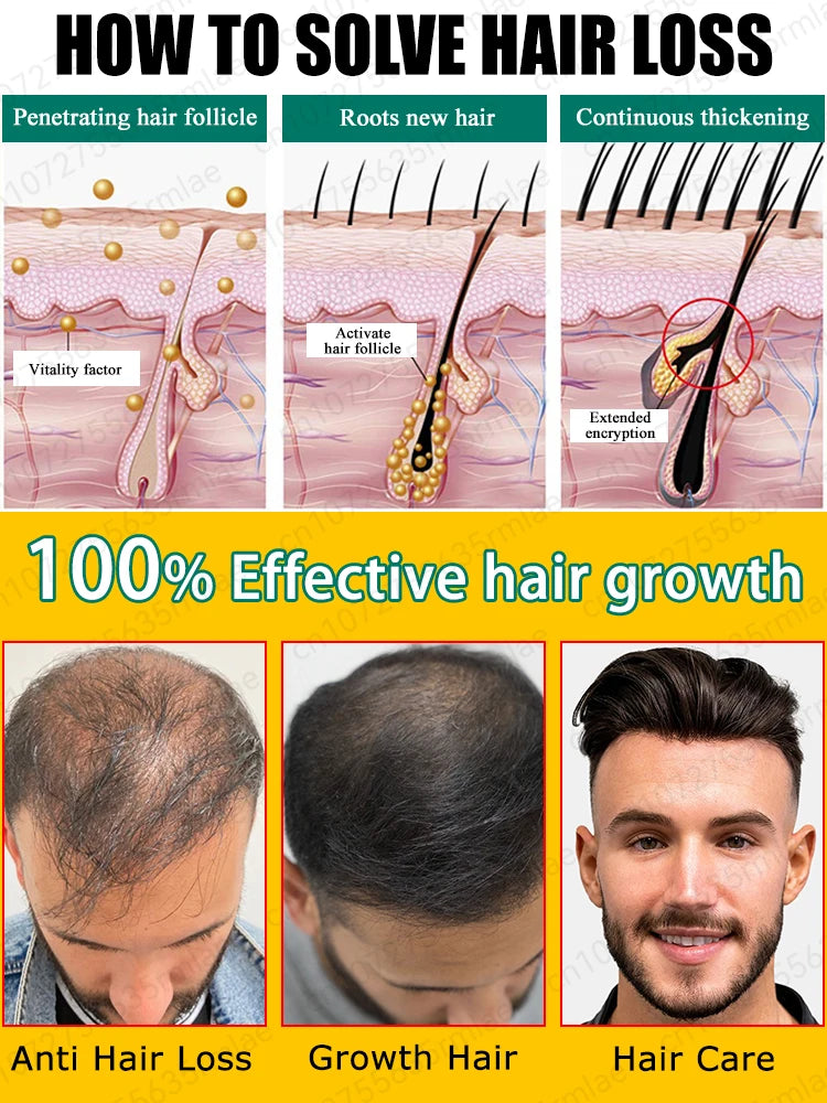 Grow cool hair secretly and surprise everyone. Say goodbye to baldness and hair loss now
